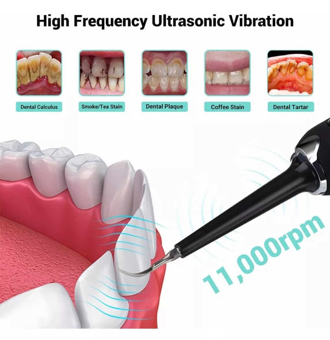 Removedor De Cálculos Dentales Eléctrico Raspador De Sarro.