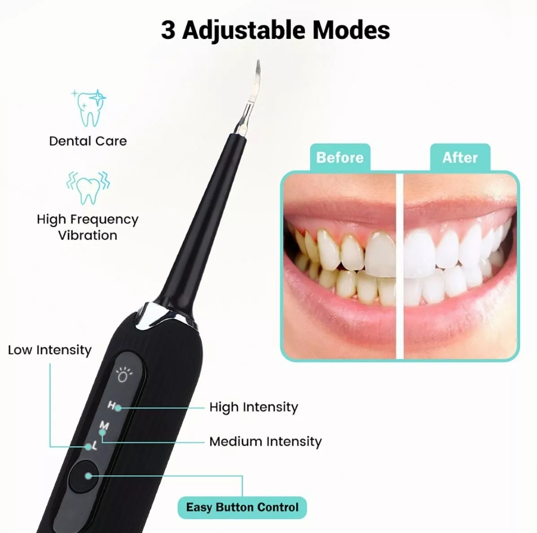 Removedor De Cálculos Dentales Eléctrico Raspador De Sarro.