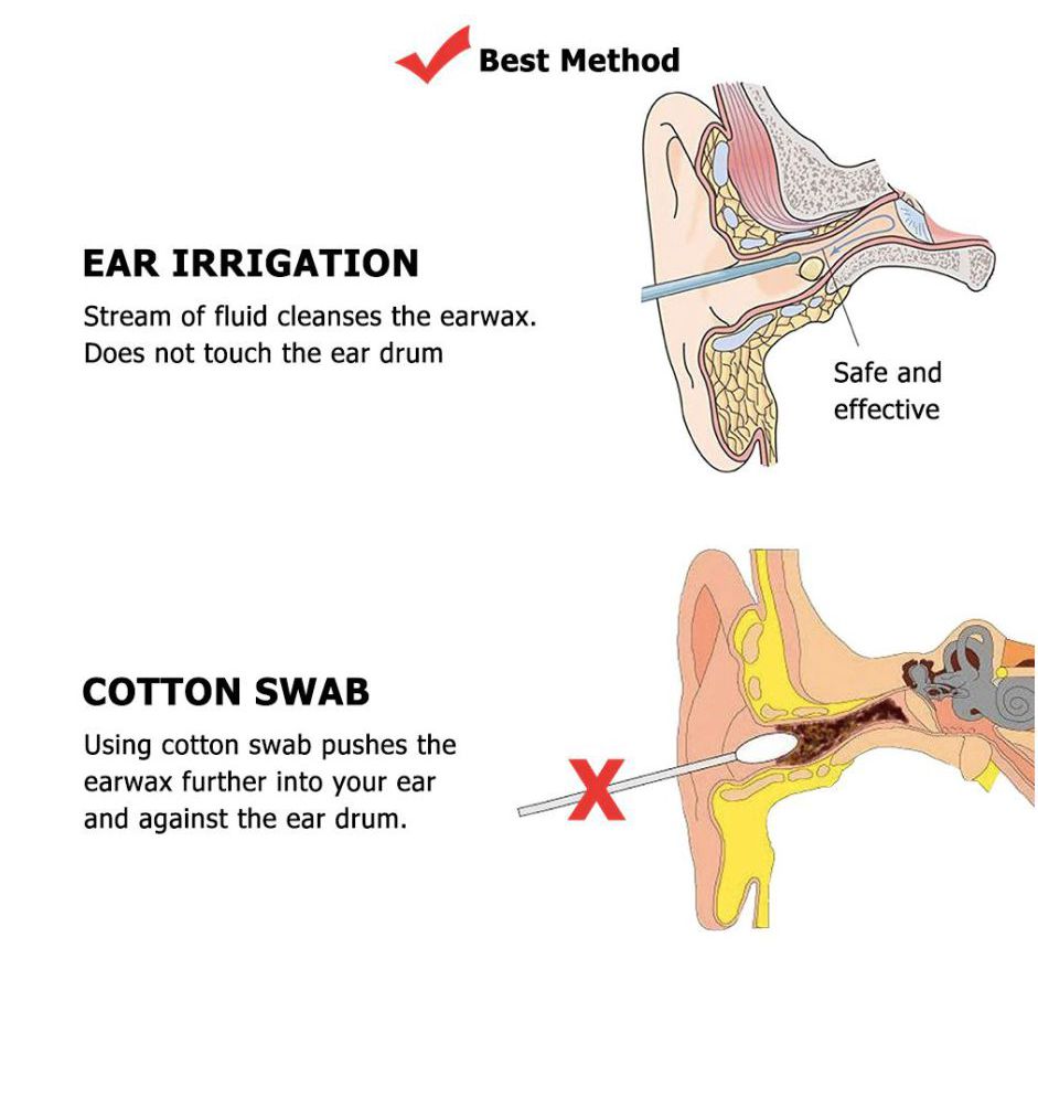 Kit Limpieza Para Oídos Remueve Cerilla Lavado Oido Nadador