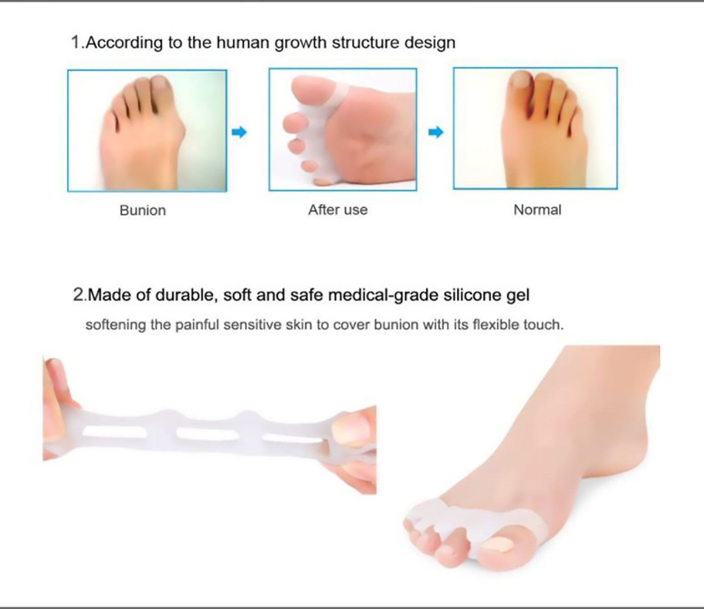 MADIOLA - Separador de Dedos del Pie, Espaciadores de Dedos, Corrector de Juanetes, Enderezador, Alivia el Juanete, Dedos Superpuestos, Dedos en Garra, Dedos de Martillo - Un Par-ROSA