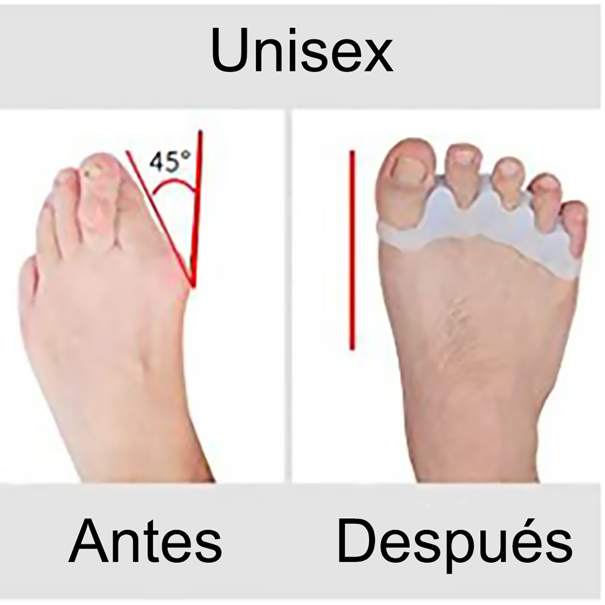 MADIOLA - Separador de Dedos del Pie, Espaciadores de Dedos, Corrector de Juanetes, Enderezador, Alivia el Juanete, Dedos Superpuestos, Dedos en Garra, Dedos de Martillo - Un Par-ROSA