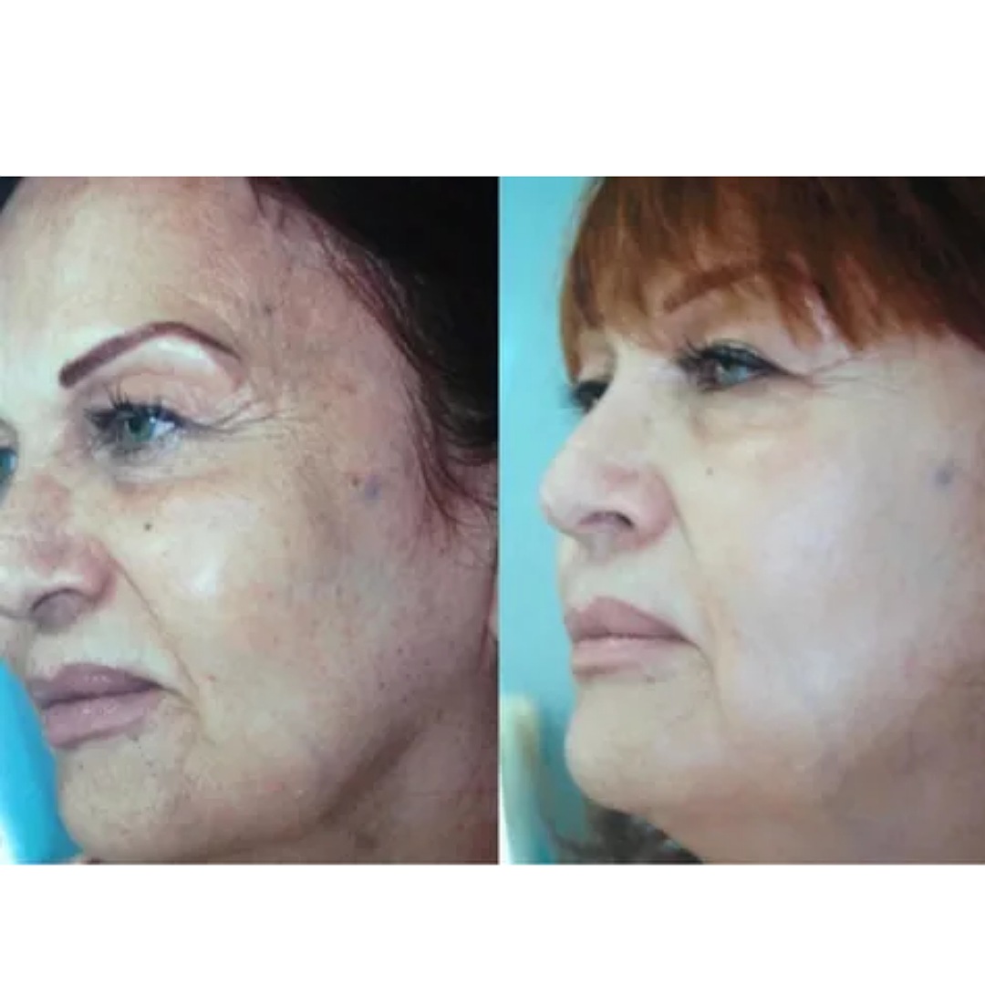 Crema Antiedad Bella Kara Anti-aging  Aplicación: Día/Noche Dama y Caballero 