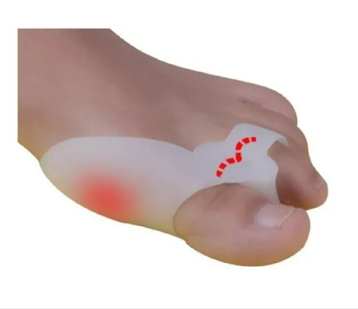 Set de Separadores de Dedo Gordo del Pie - 2 Pares