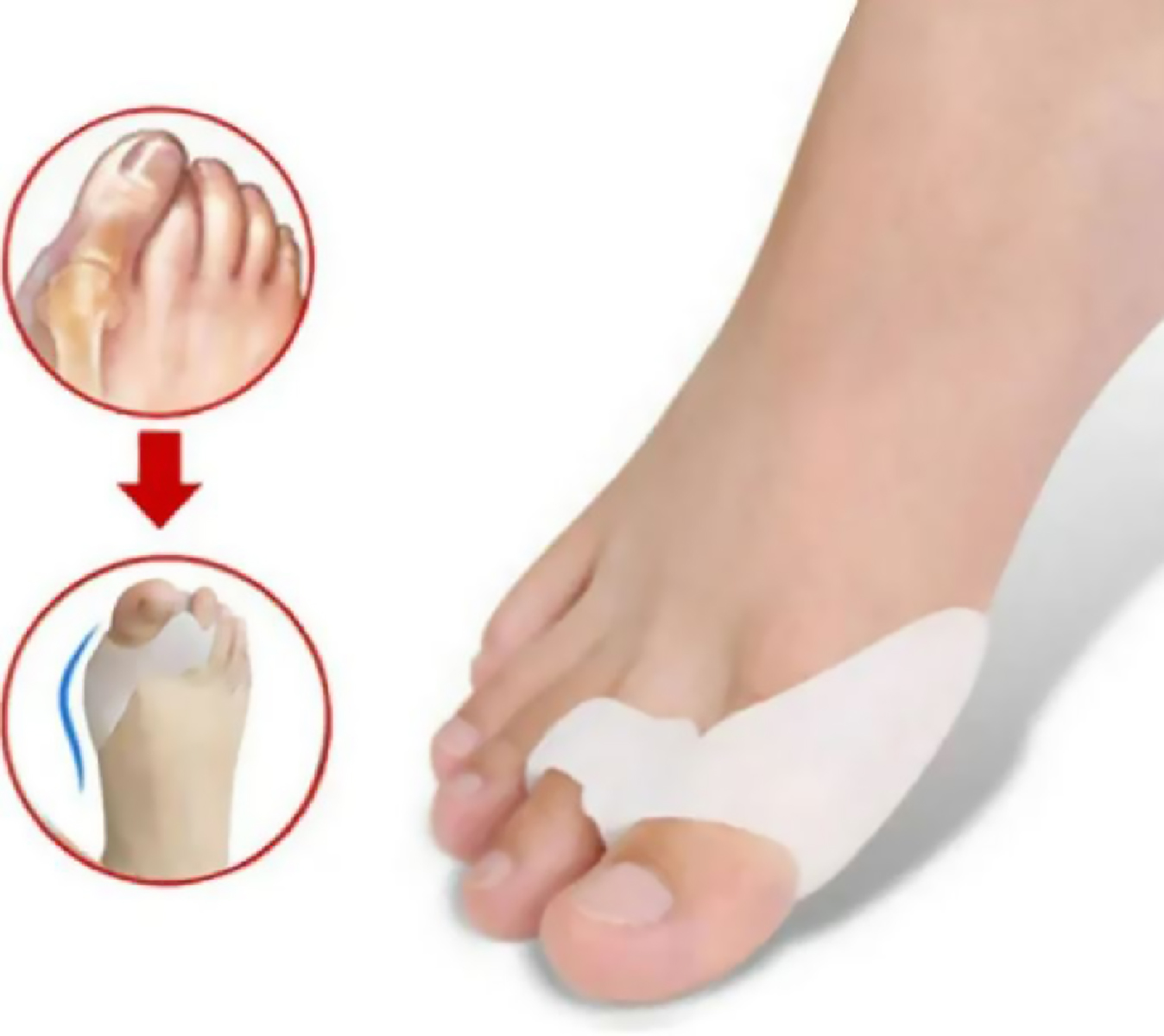 Set de Separadores de Dedo Gordo del Pie - 2 Pares