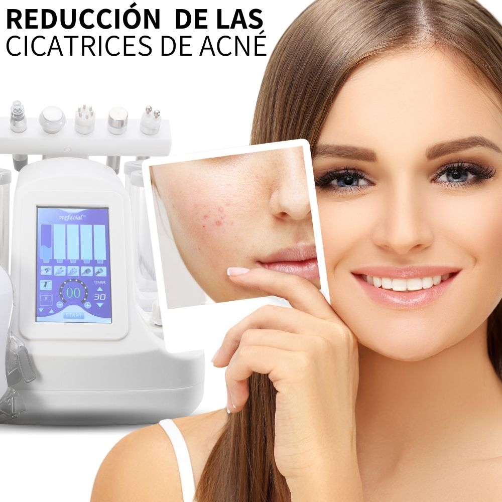 Mascara De Terapia Facial 7 En 1 Dermoabrasión Hidrofacial