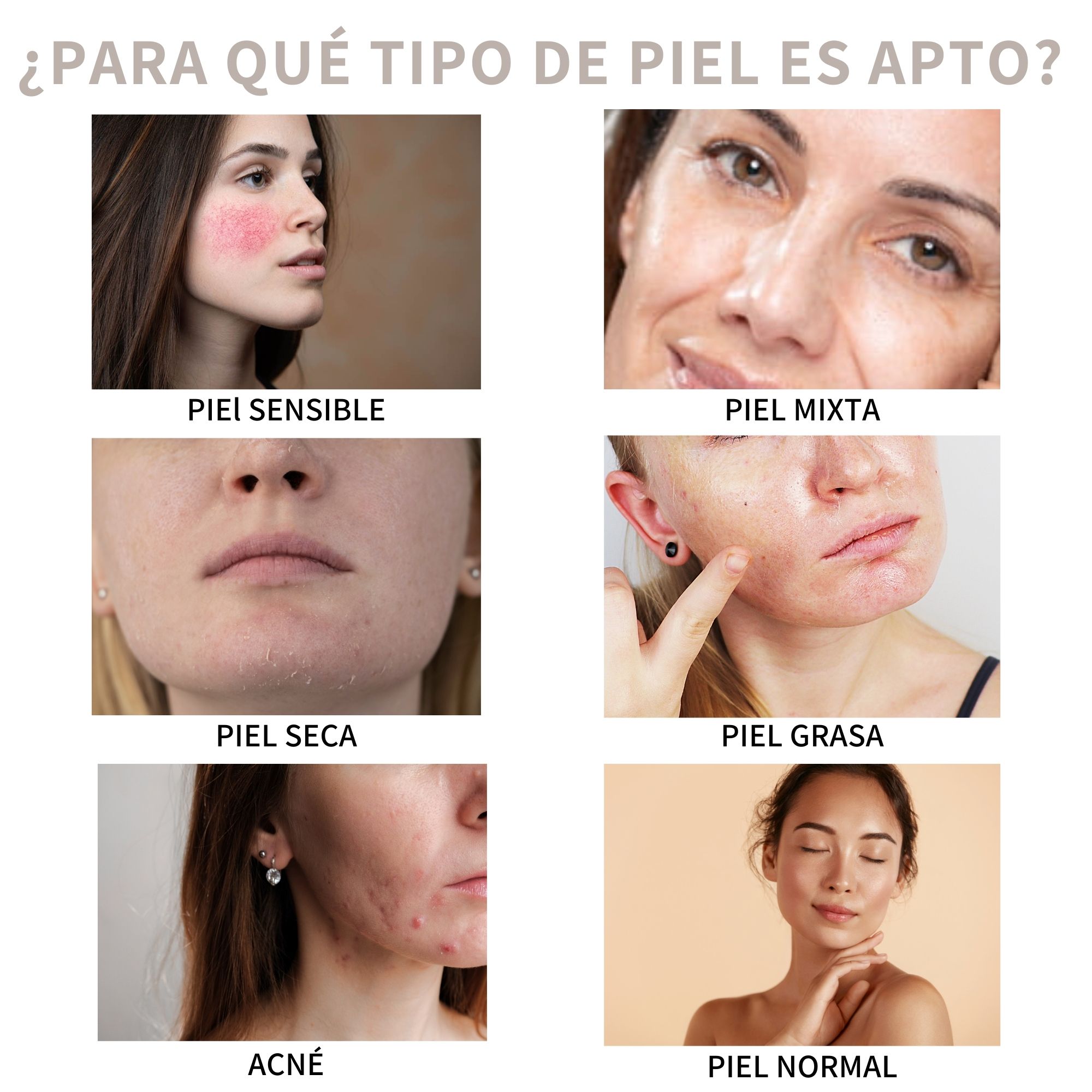 The Ordinary Acido Azelaico Azelaic Acid Suspension 10% 30ml