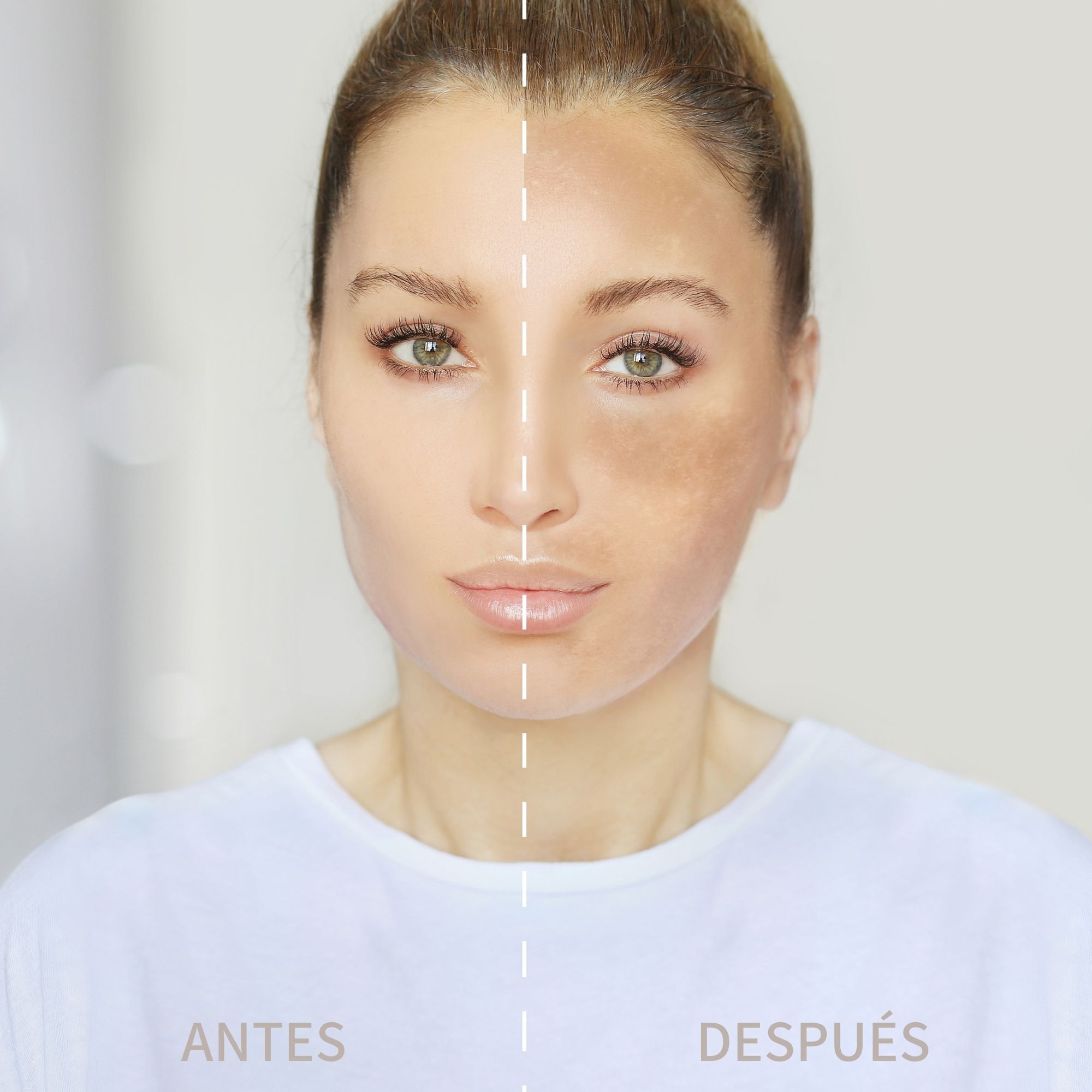 The Ordinary Acido Azelaico Azelaic Acid Suspension 10% 30ml