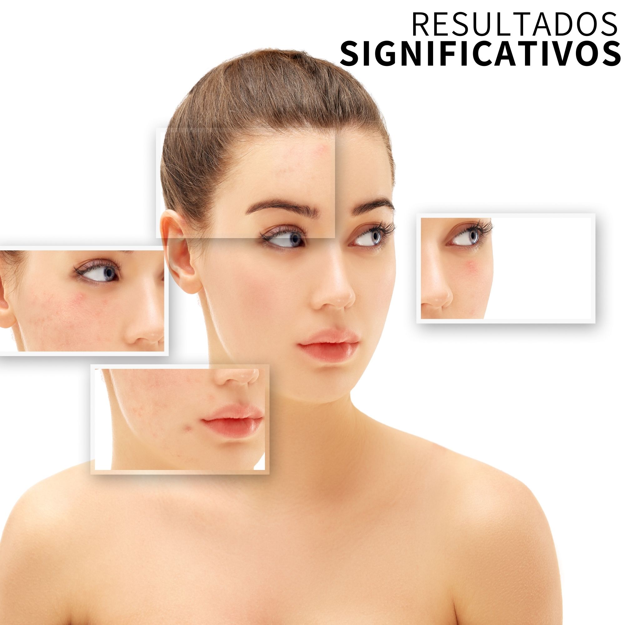 Tónico Toning Solution The Ordinary Glycolic Acid 7% 240 Ml