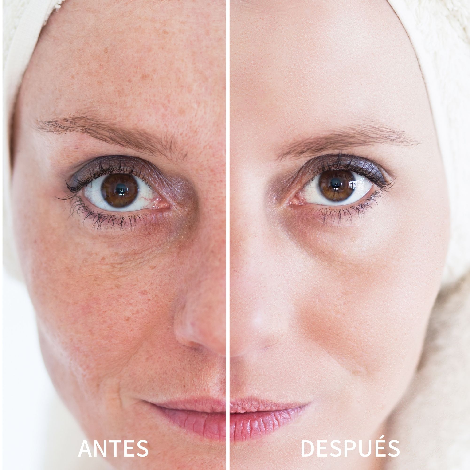 Tónico Toning Solution The Ordinary Glycolic Acid 7% 240 Ml