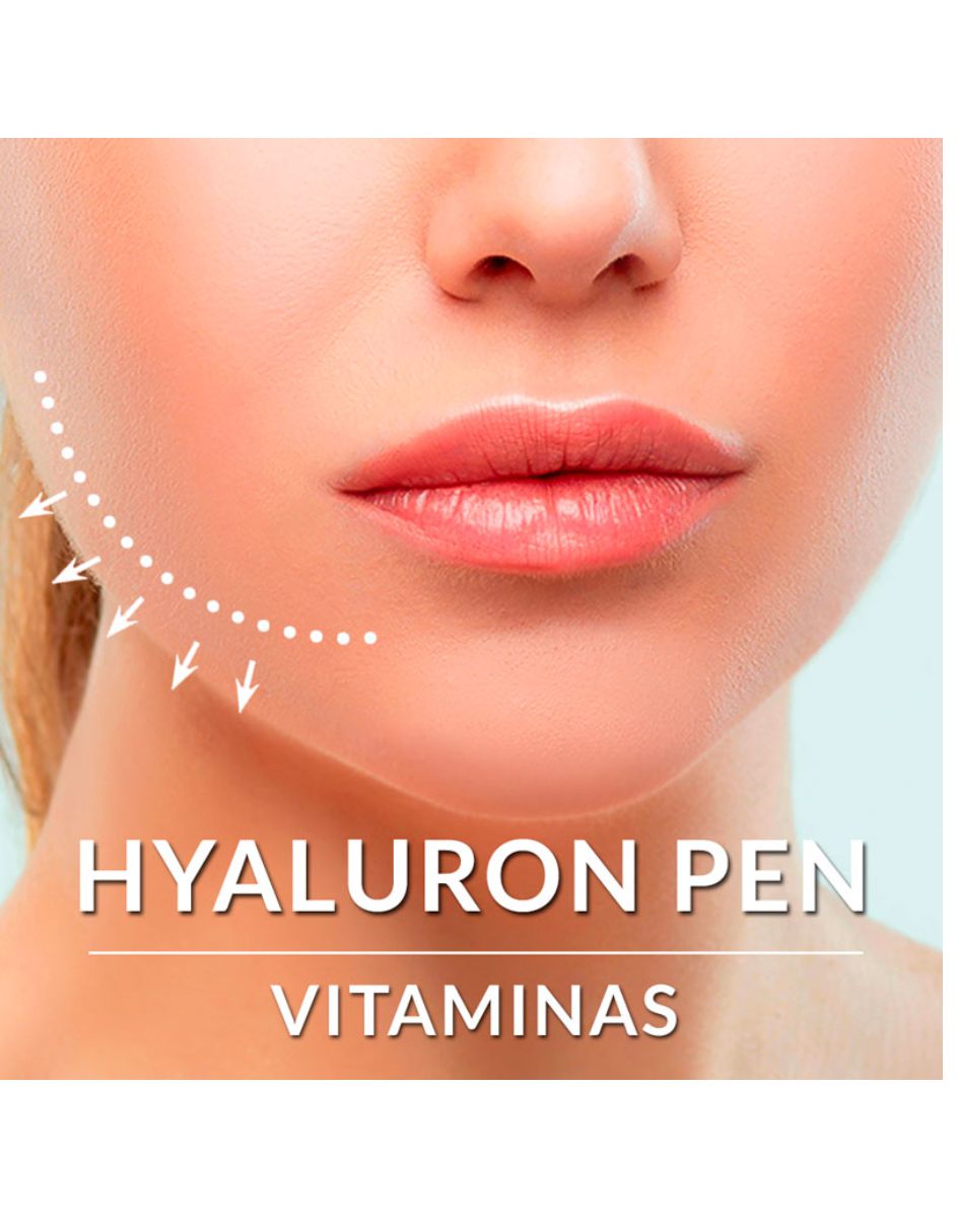 Hyaluron Pen Hialuronic Mesoterapia Rellenos 