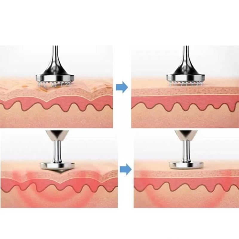 Repuesto redondo para electrolifting marca plasma pen liso y estriado