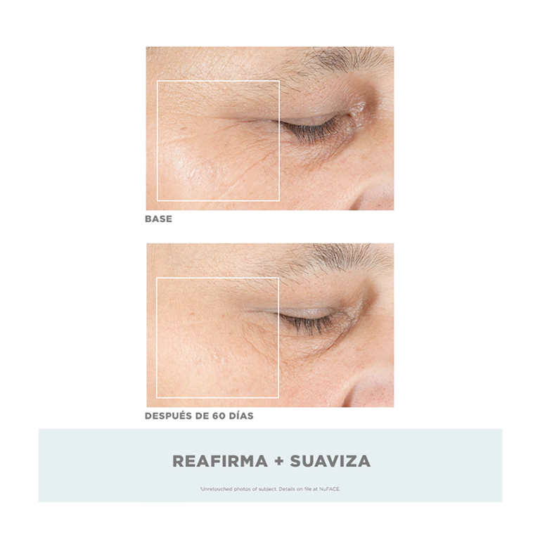 Aditamento ELO para labios y ojos para Trinity Clásico | Skin Care Mujer