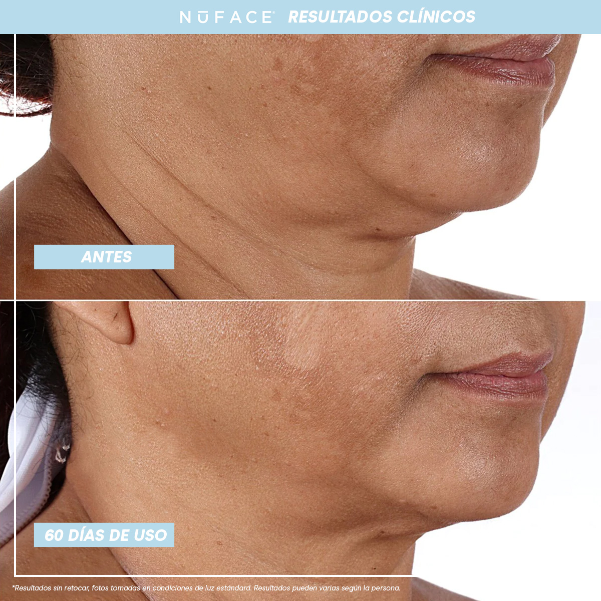 Dispositivo de Microcorriente NuFACE MINI+® Sandy Rose 