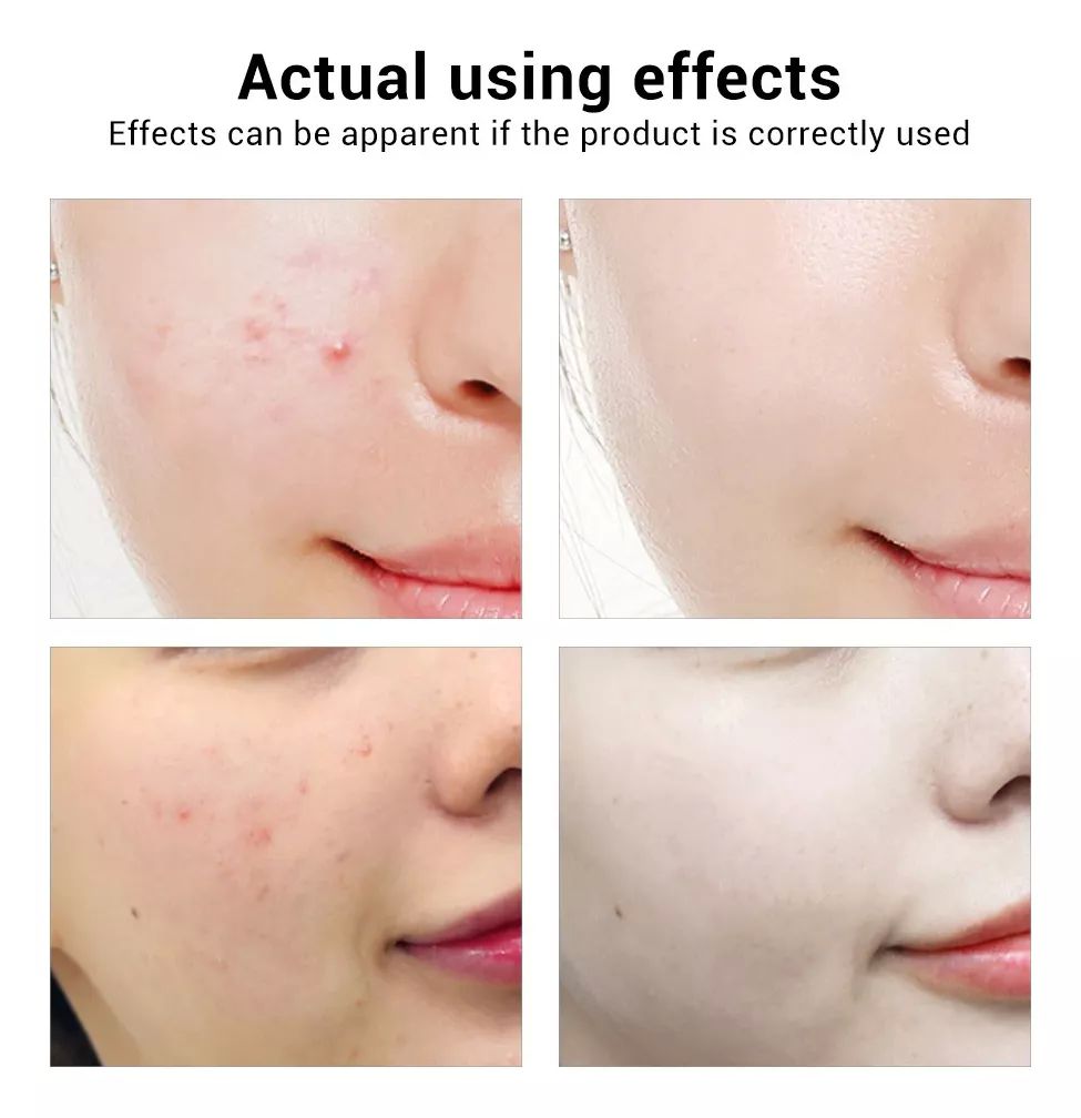 Serum Facial Bioaqua Pure Gold Acido Hialuronico Hidratante 100ml