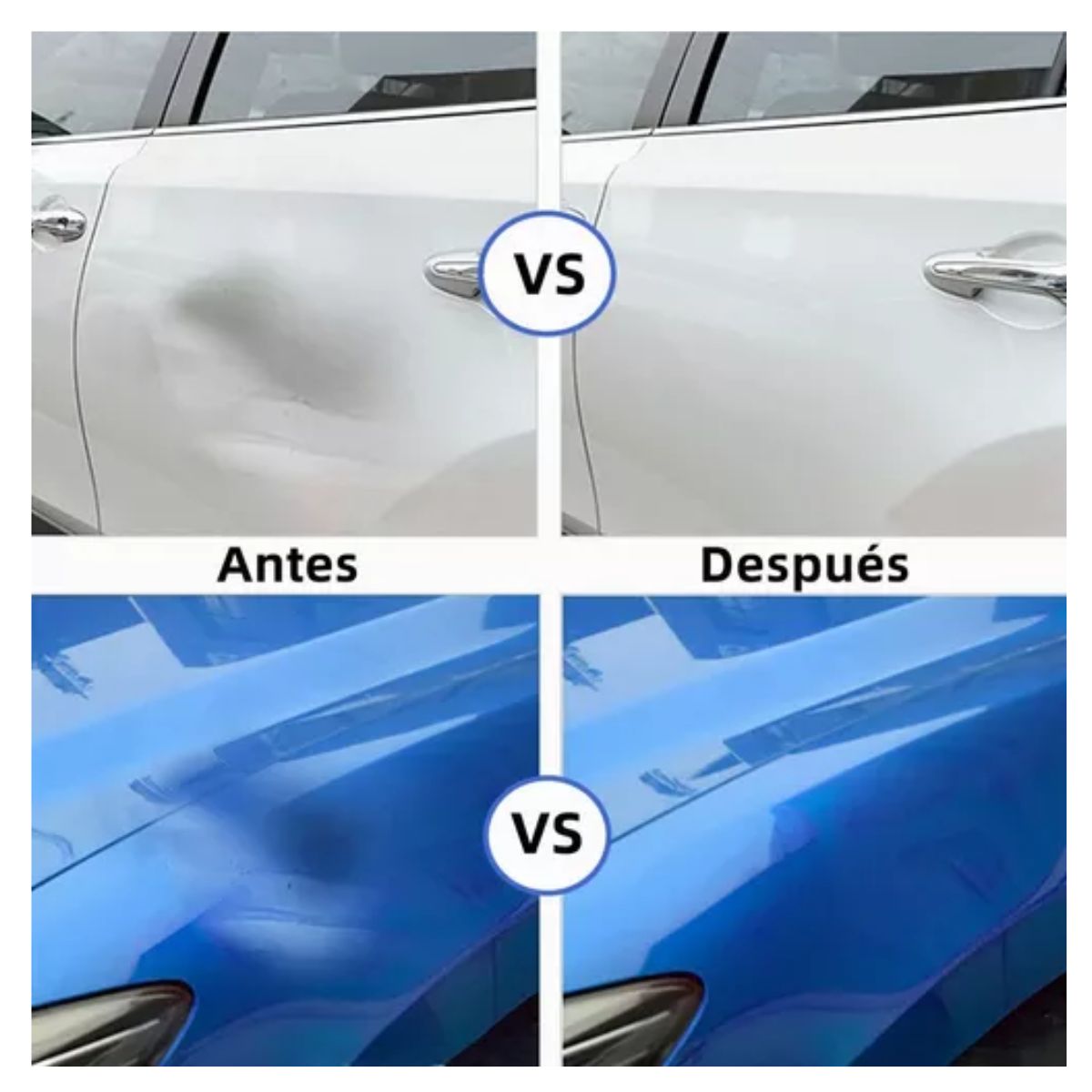 Kit Ventosa Saca Abolladuras Chupon Para Abolladuras Autos