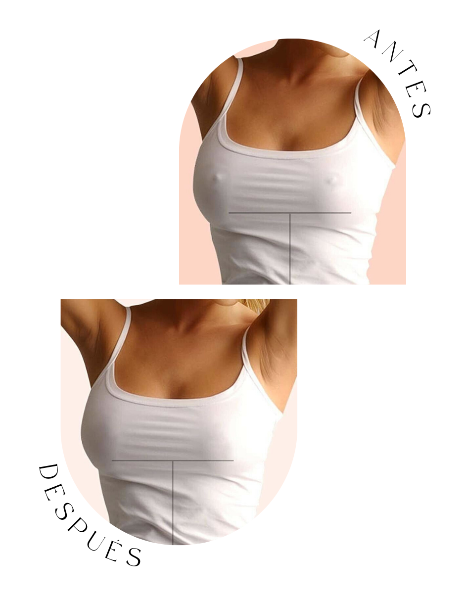 Nippis Invisibles Crema 