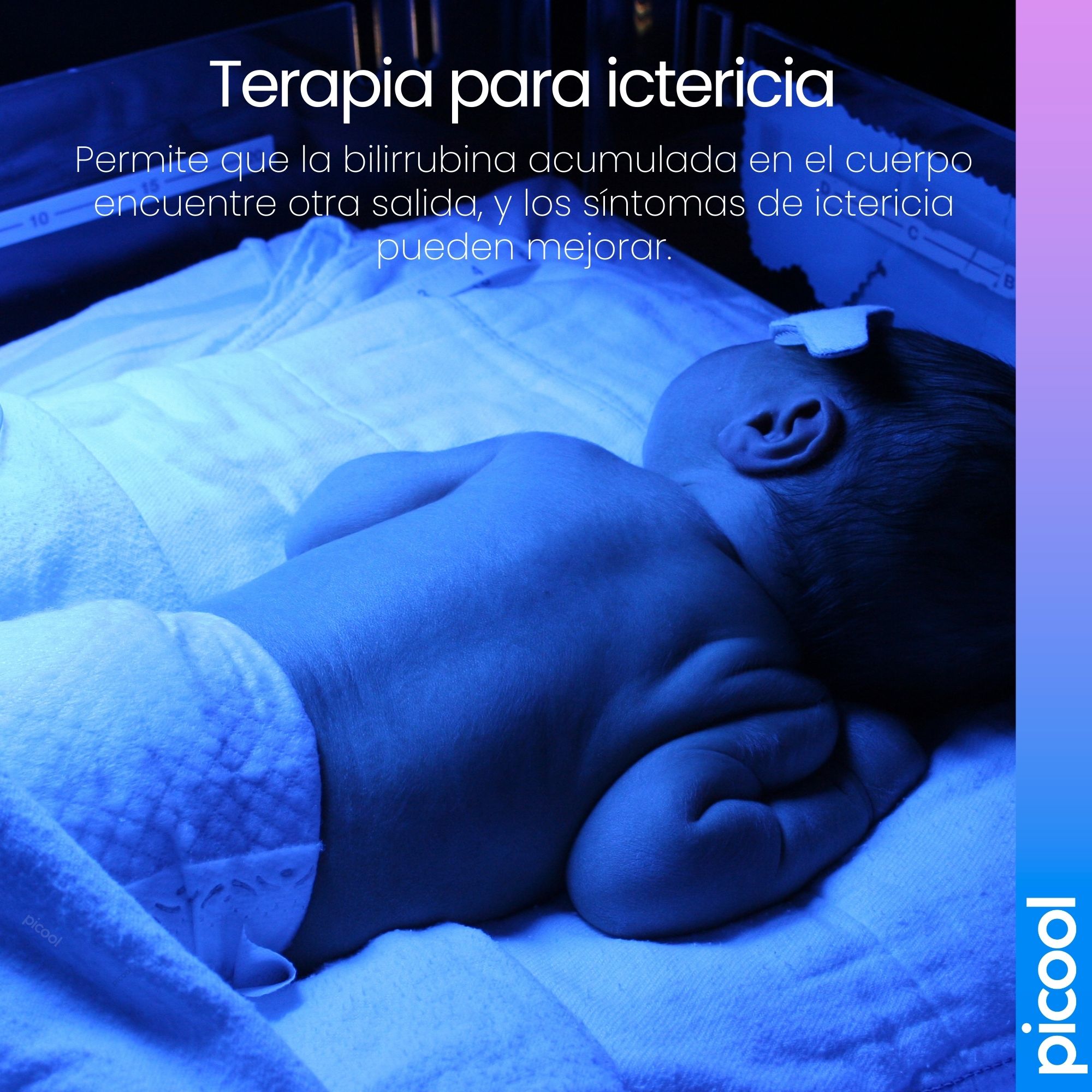 Lampara De Luz Azul Para Cuidado Del Bebe Cunero Ictericia