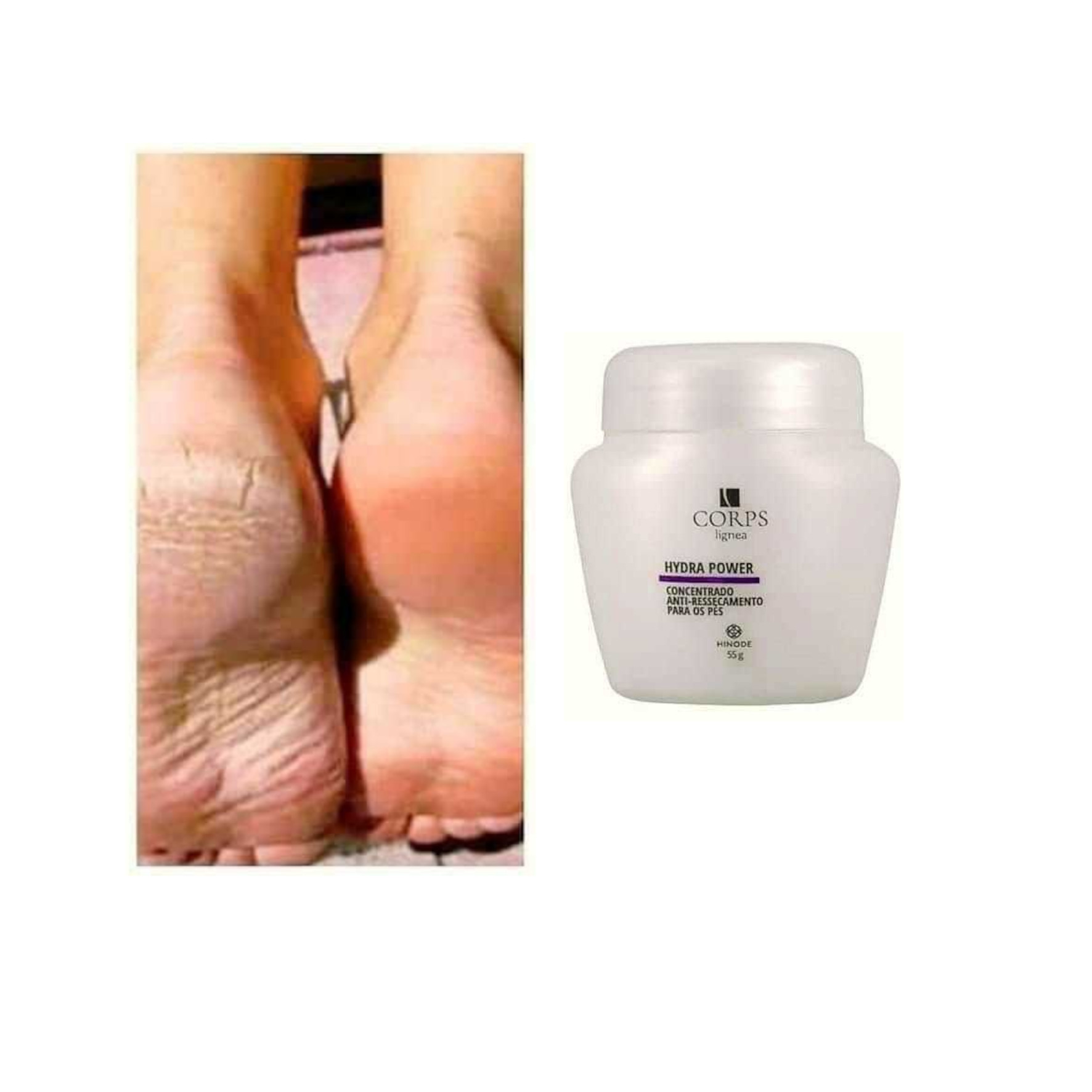 Loción Hidratante STRAX con Obsequio Hidra Power