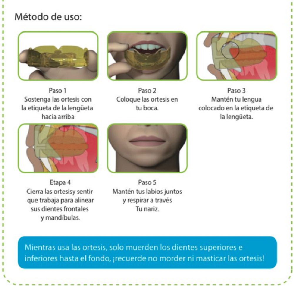 Guarda Bucal Infantil. Ortodoncia Primaria y Mixta para niños de 3 a 6 años. Bruxismo.