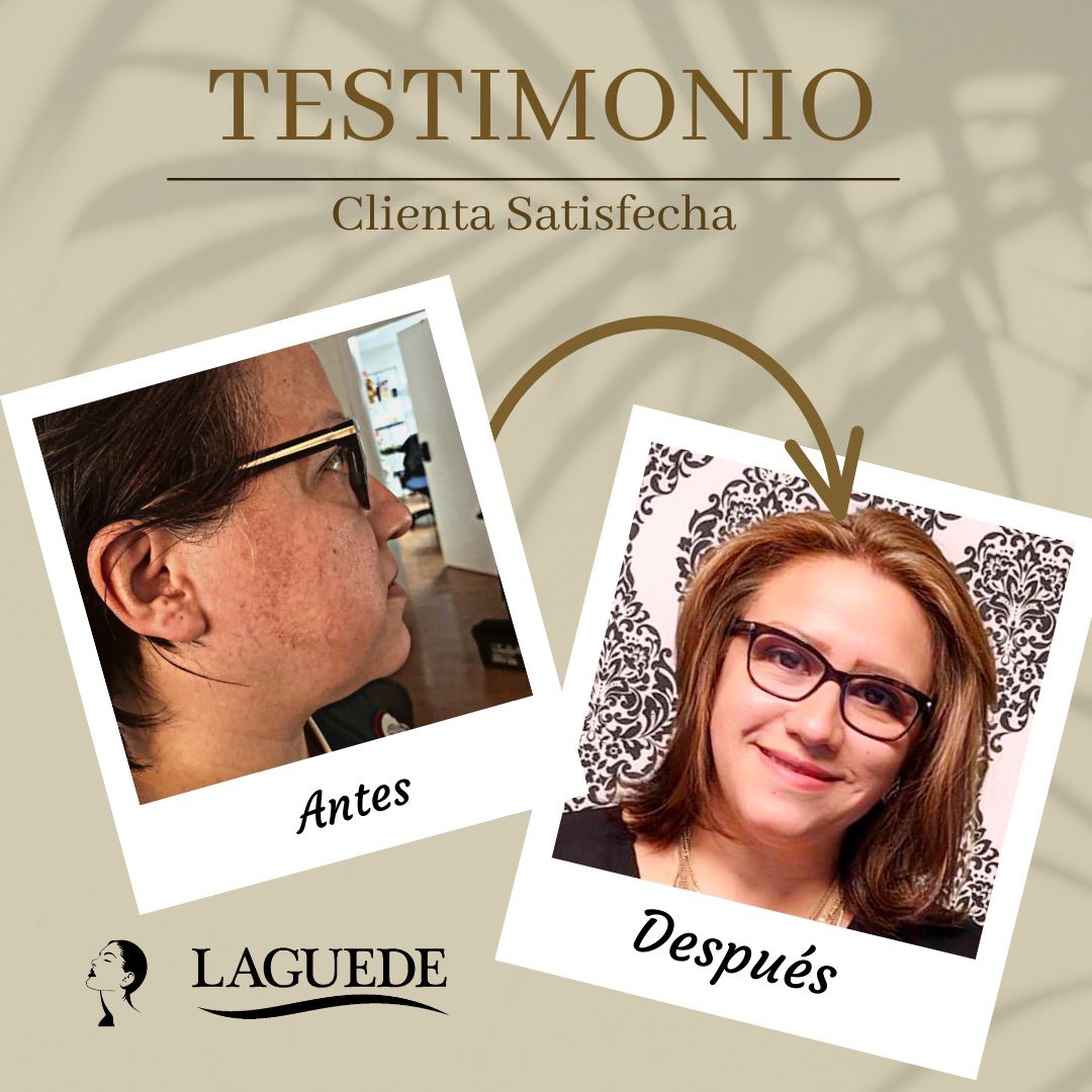 Kit Aclarante Facial Anti-Edad Crema de Día, Gel de Noche 50g y Jabón De Arroz 90g Piel seca/normal Laguede .