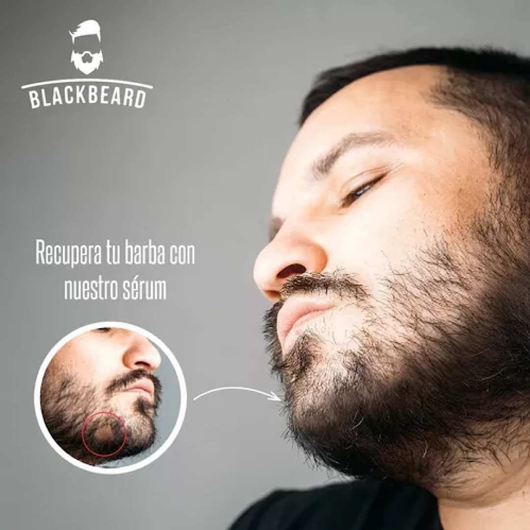 Tónico Crecimiento Barba Blackbeard Minoxidil 2 Meses