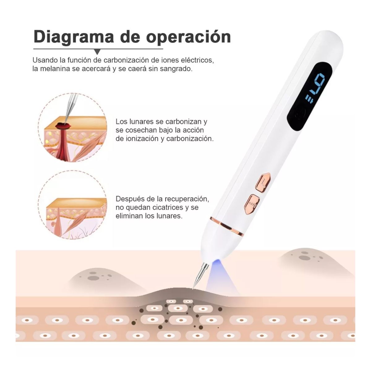 Herramienta Para Quitar Verrugas Pluma Cauterizador