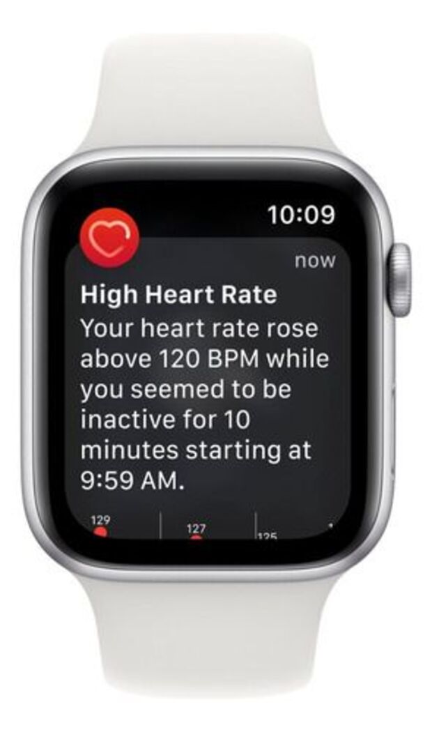 Apple Watch Se 2da Generación Gps De 44 Mm Silver