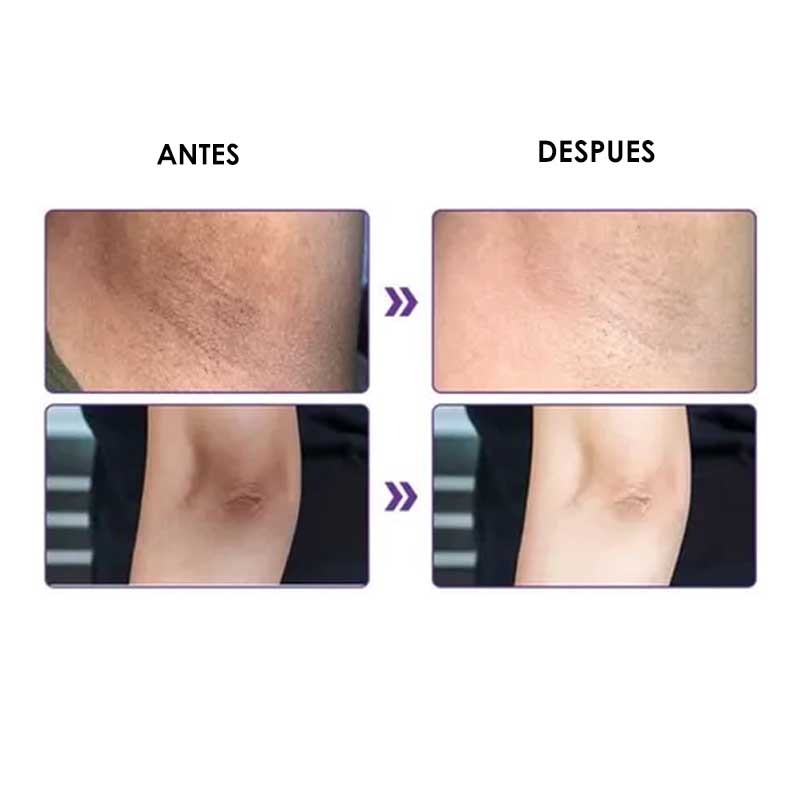 Crema Blanqueadora Aichun Beauty + Colageno Area Sensible Elimina Manchas 52ml