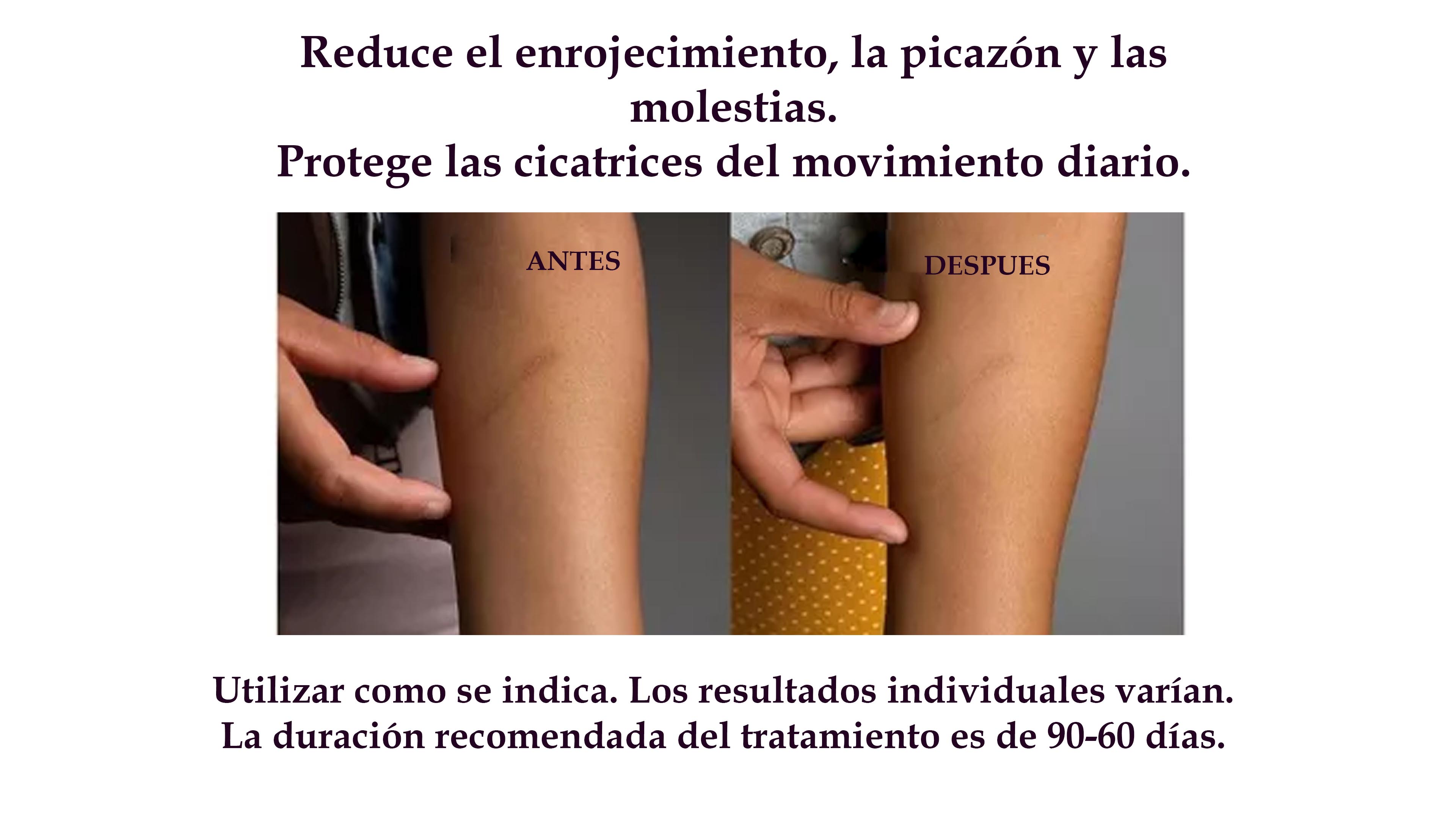 Parche de Silicon Tranparente ScarAway Elimina Cicatrices 6pz 