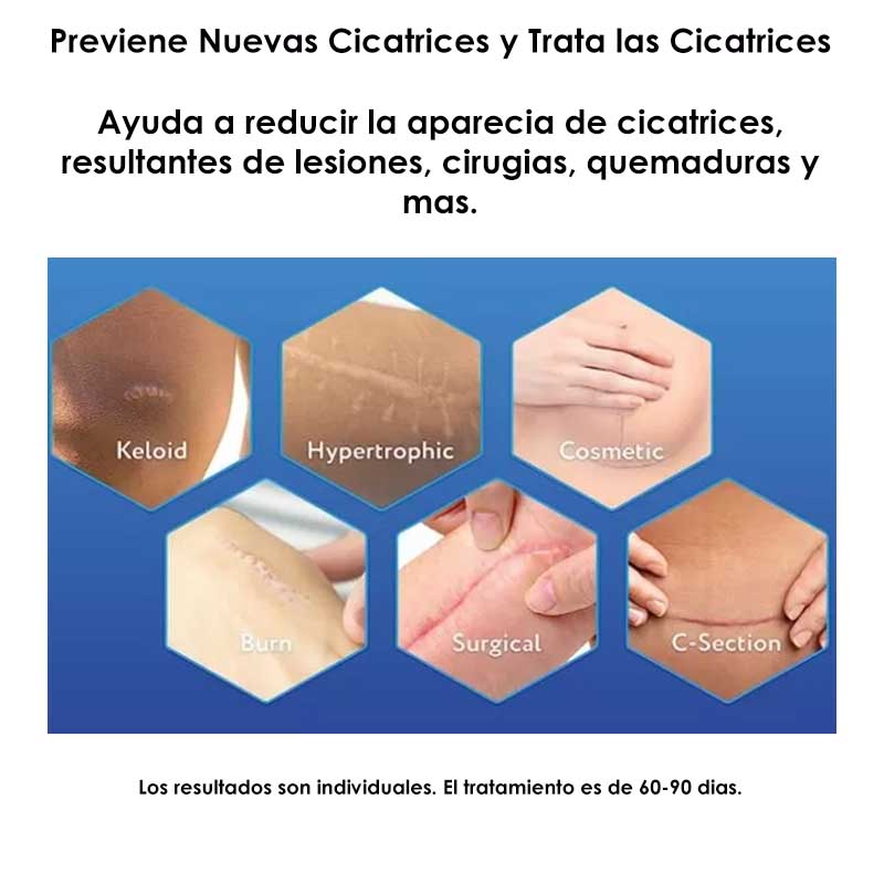 Parches de Silicon ScarAway 3.8 x 7.6 cm Elimina Cicatrices 4 pz 