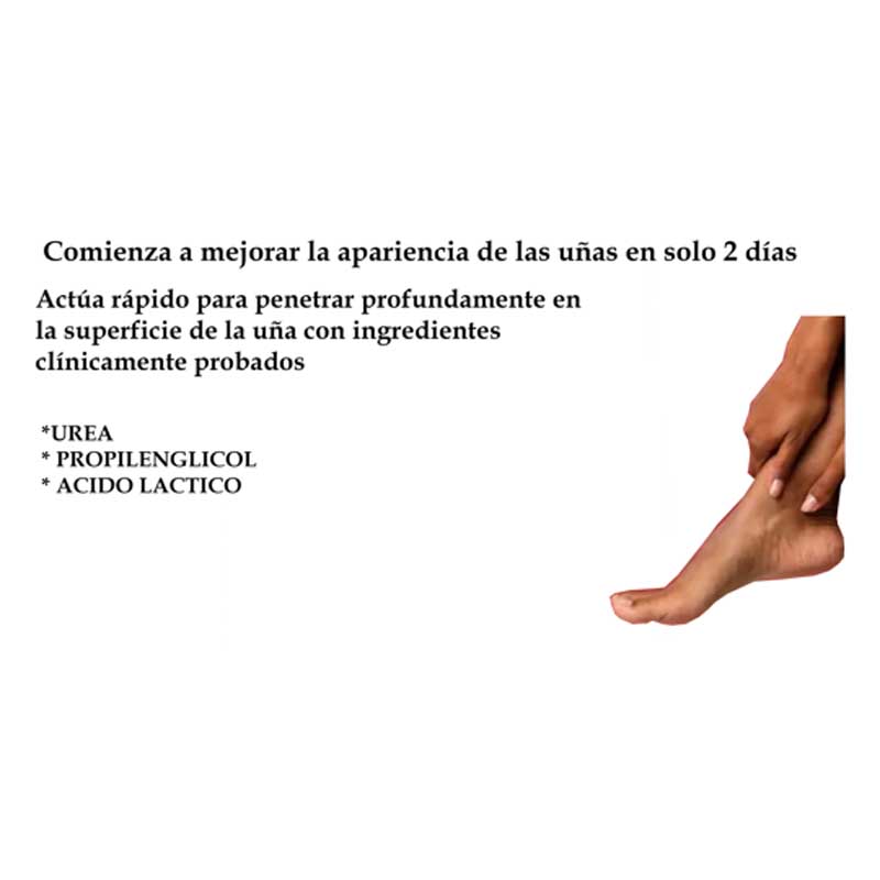 Tratamiento Uñas Decoloradas Kerasal Antihongo 10ml 
