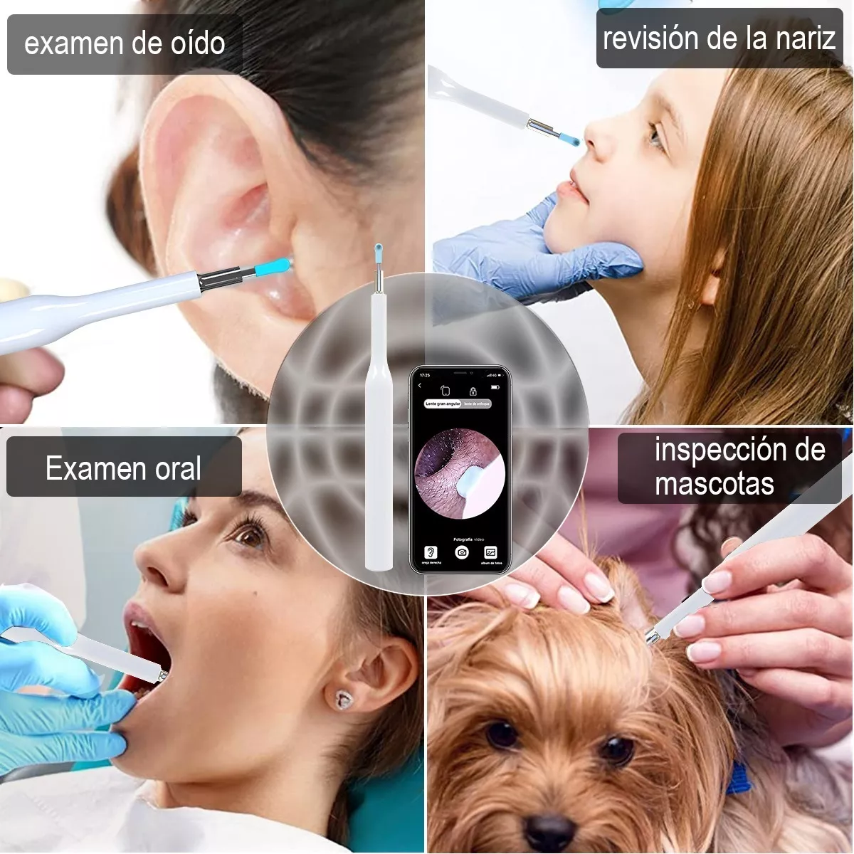 Limpiador De Oidos Cámara Otoscopio Endoscopio Wifi 1080p