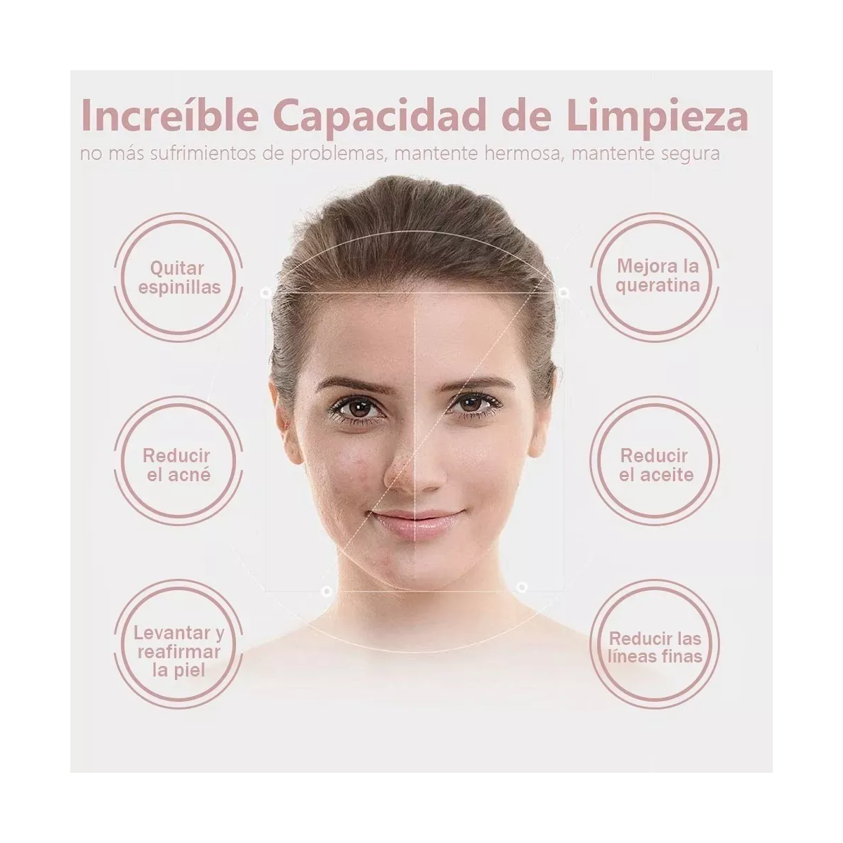 Limpiador De Poros Extractor De Puntos Negros Y Acné Facial