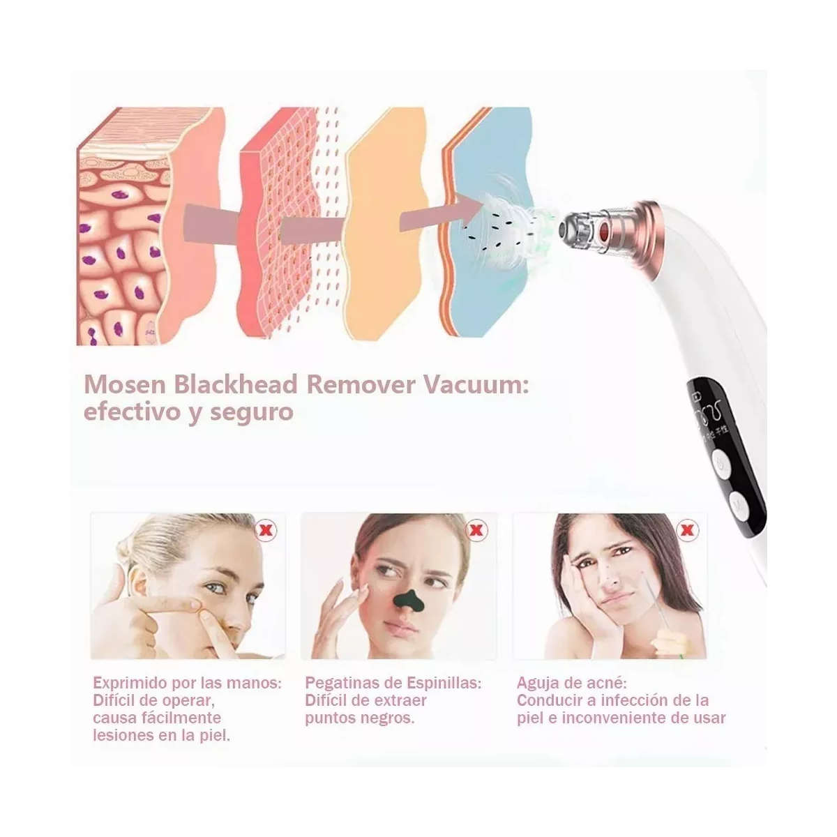 Limpiador De Poros Extractor De Puntos Negros Y Acné Facial