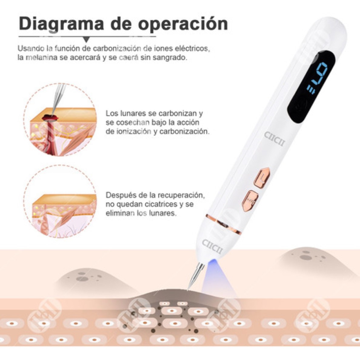 Herramienta Para Quitar Verrugas Ciicii Pluma Cauterizador Blanco