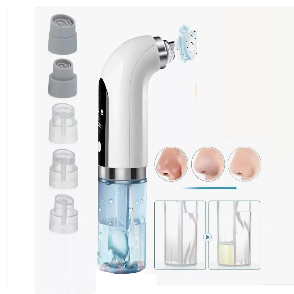 Limpiador Facial Eléctrico Succiona Puntos Negros Espinillas