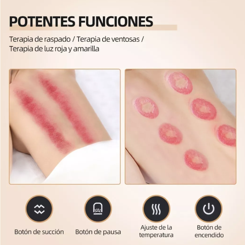 Ventosa Terapéutica Eléctrica De Masaje .