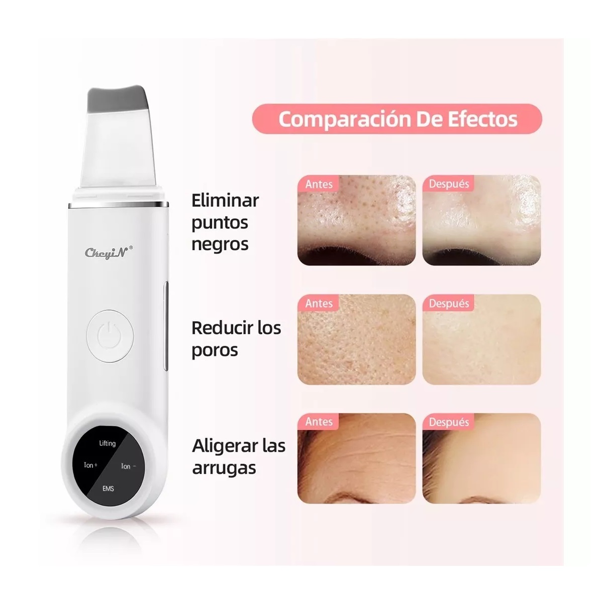Limpiador Facial Espátula Ultrasónica