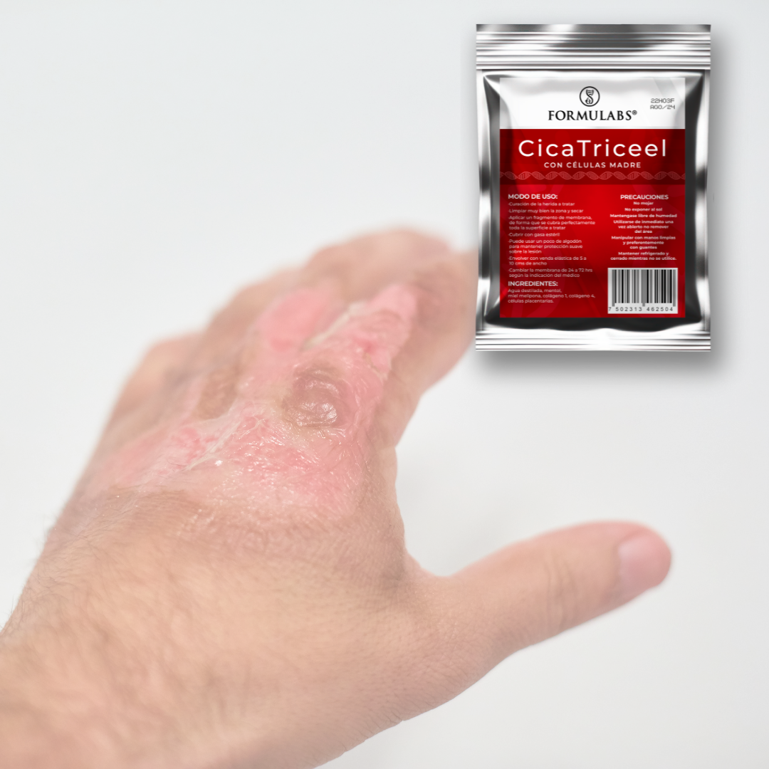 Membrana Dérmica Parches para cualquier tipo de Heridas, Quemaduras y Ulceras Diabéticas - Cicaticreel Formulabs