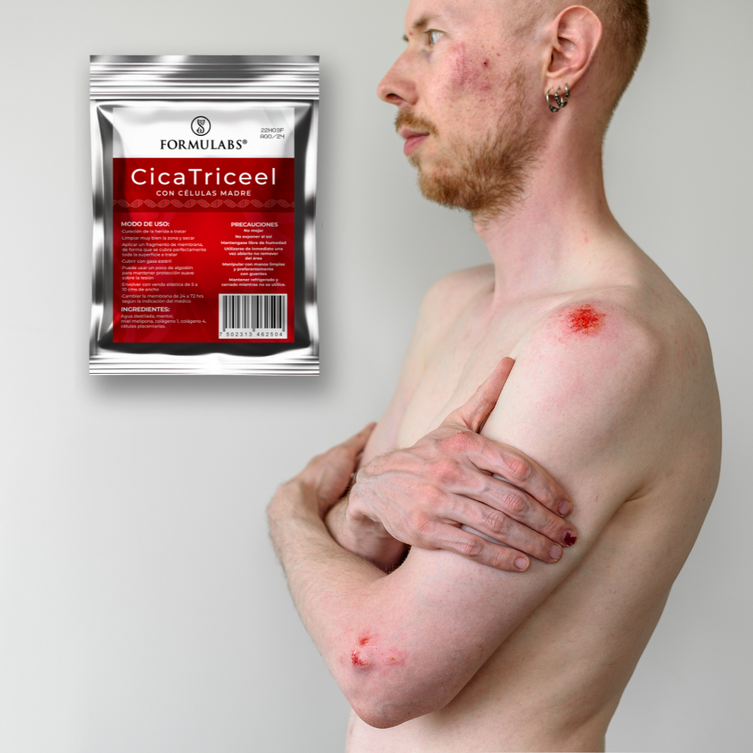 Membrana Dérmica Parches para cualquier tipo de Heridas, Quemaduras y Ulceras Diabéticas - Cicaticreel Formulabs