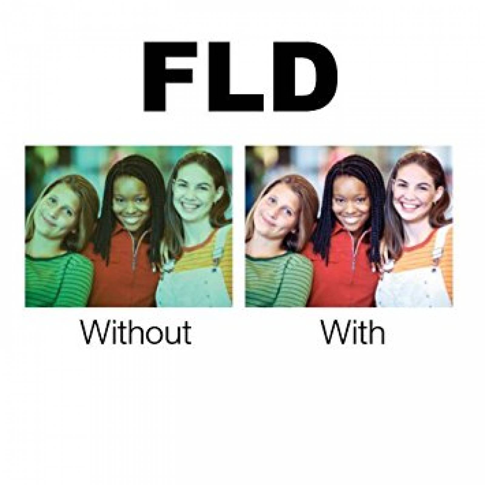 Kit De Filtros Plr 86mm, 3 Pzs De Alta Resolucion Uv Fld Cpl