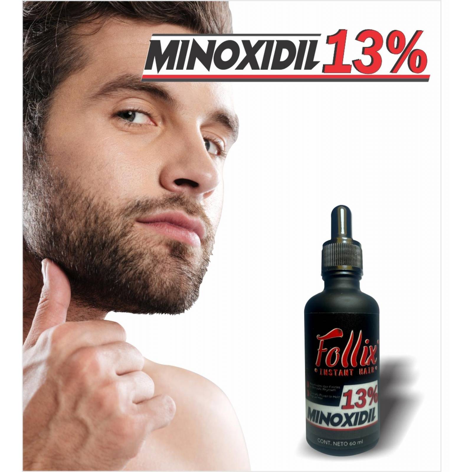 Minoxidil Follix 60Ml