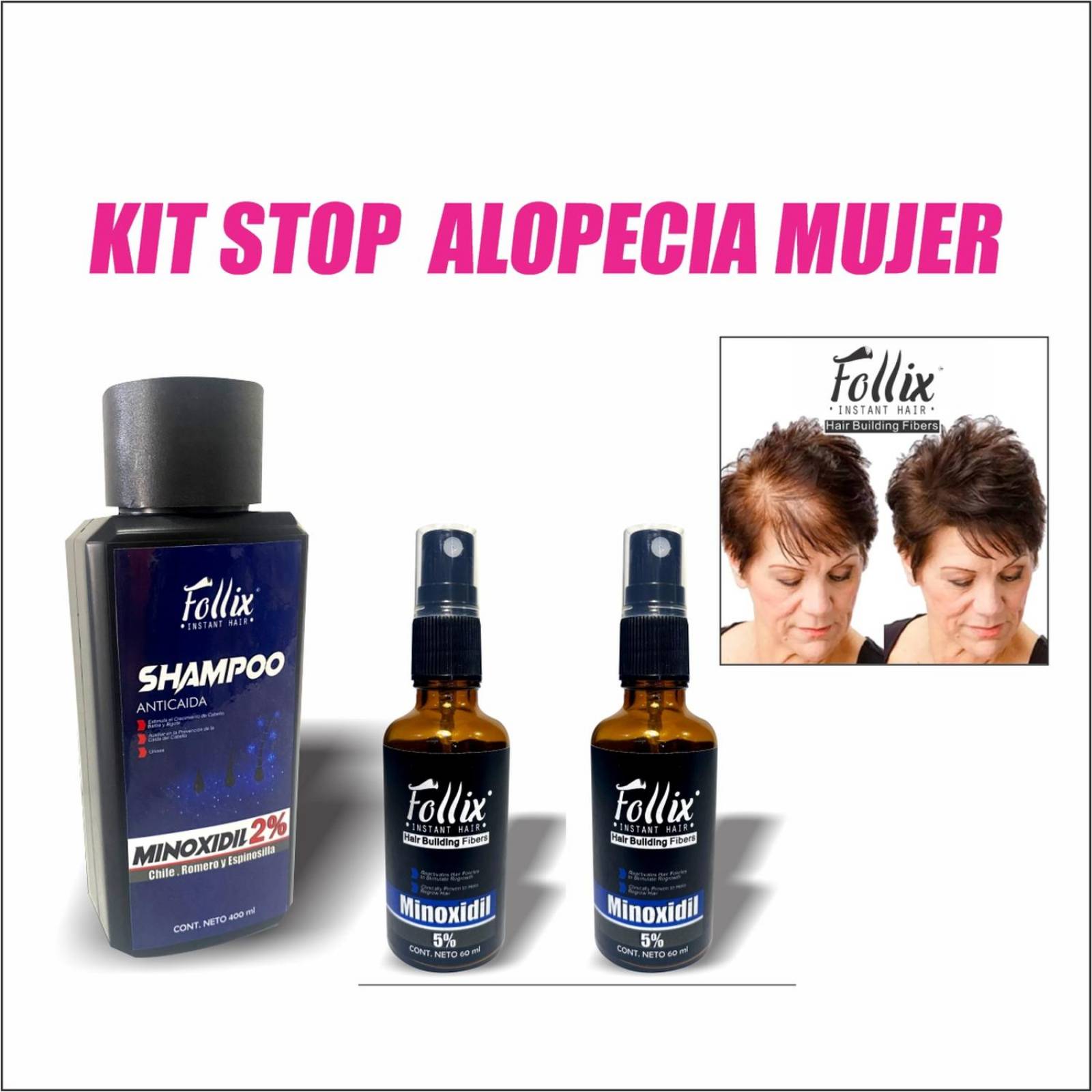 Kit Stop Alopecia 2, Con 2 Minoxidil 5 Y Shampoo Minoxidil 