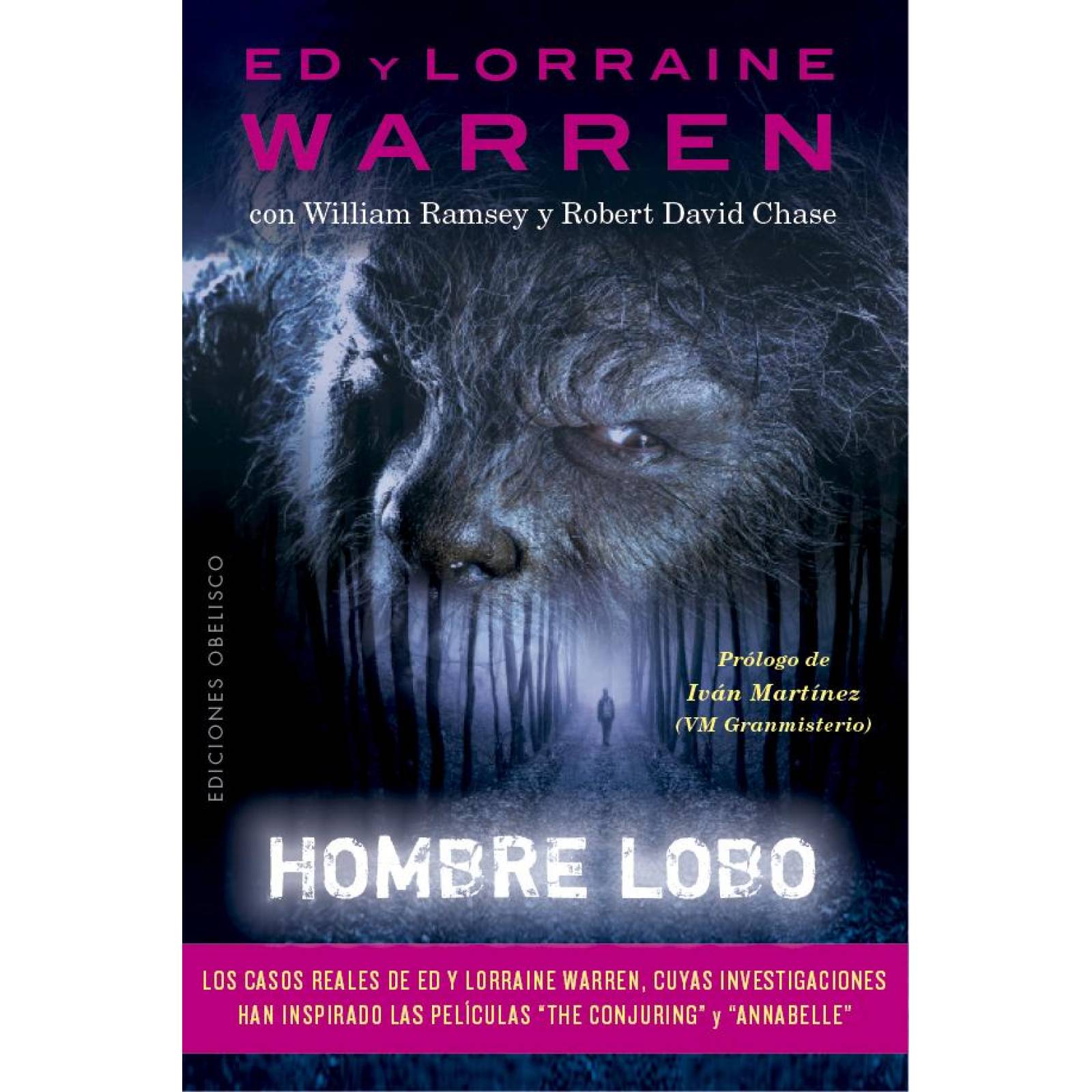 Hombre lobo 