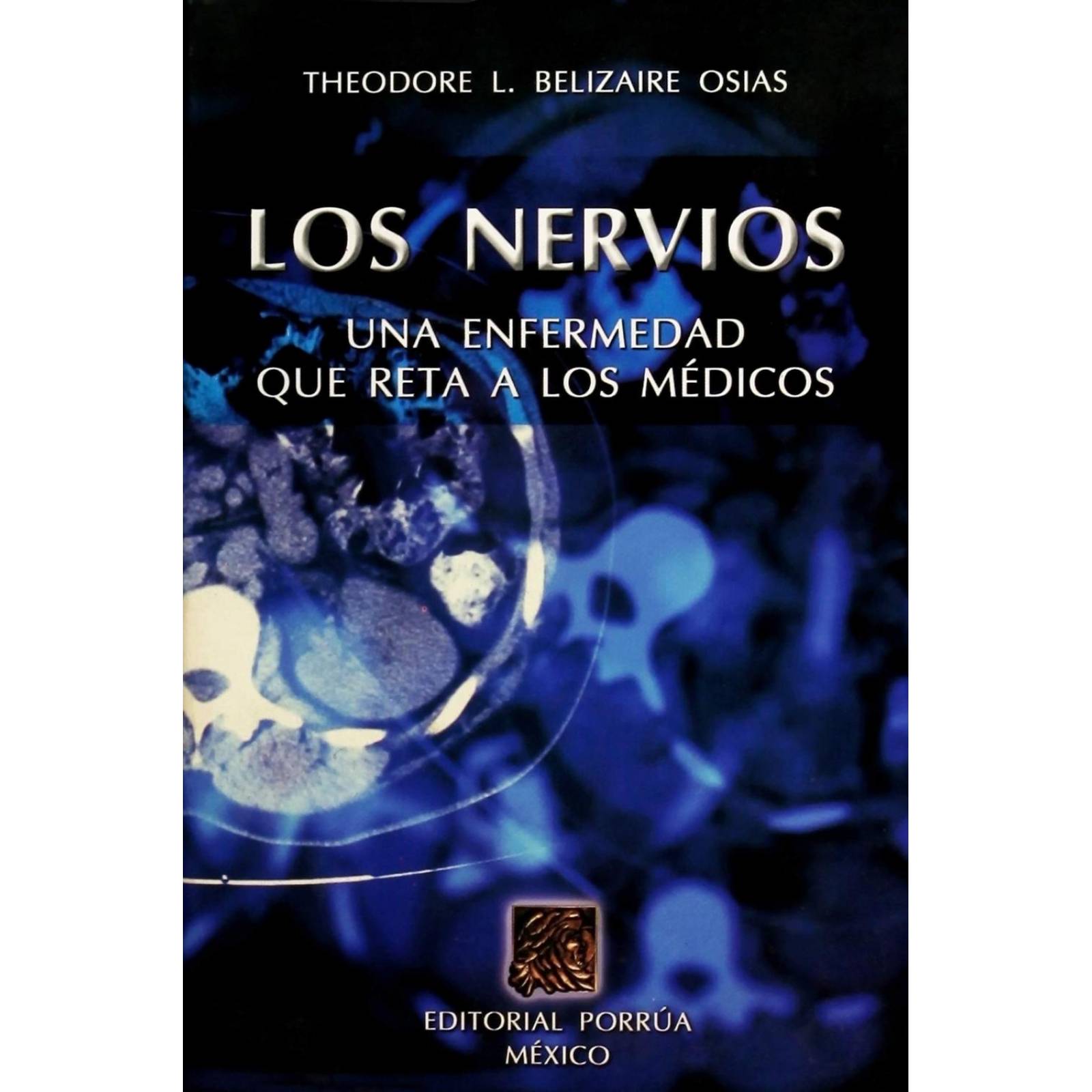 Los nervios: una enfermedad que reta a los médicos 