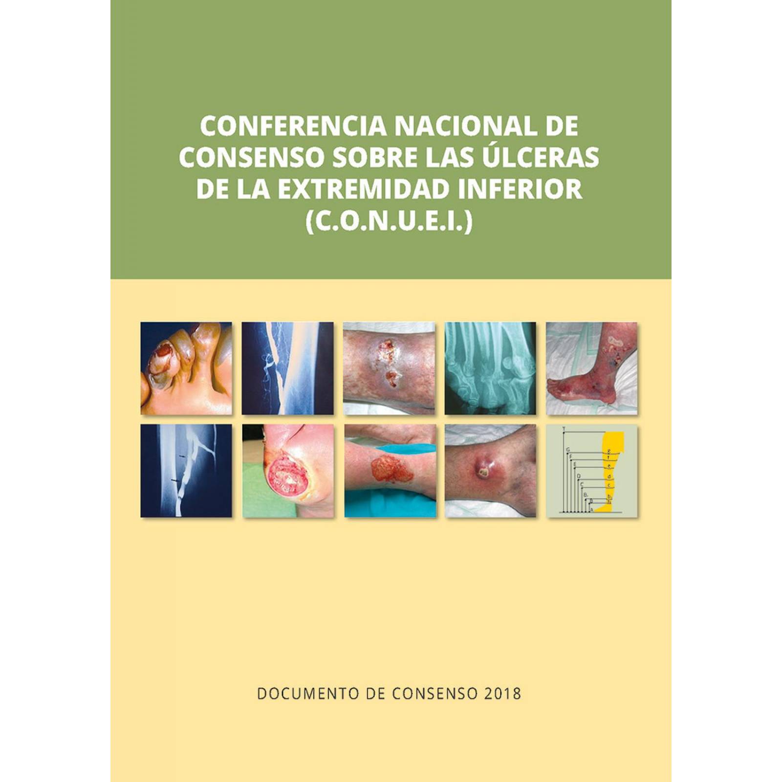Conferencia Nacional de Consenso sobre Úlceras de las Extremidades Inferiores (C.O.N.U.E.I.)