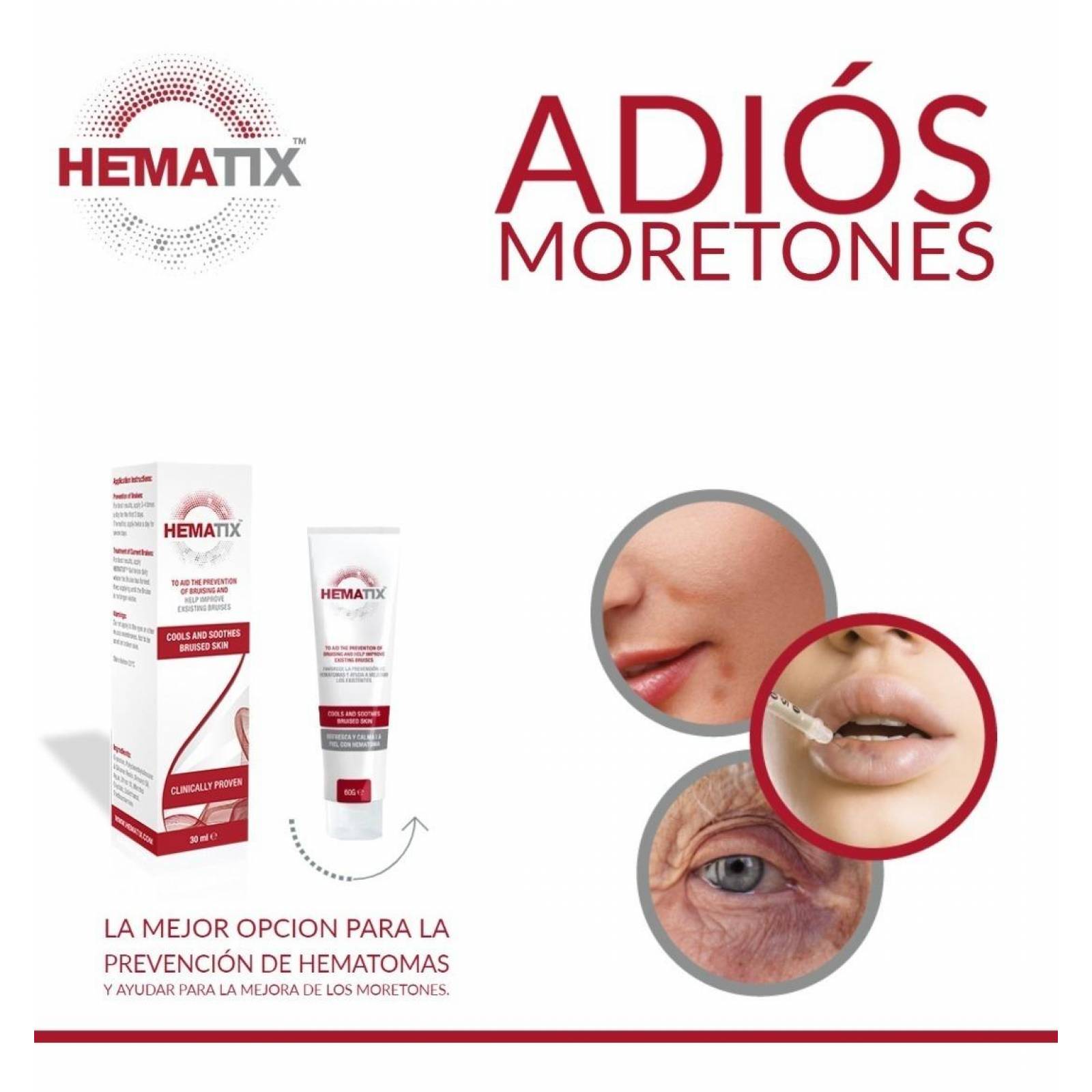 Hematix Gel 30g Desvanecedor De Moretones, Hematomas, Piel