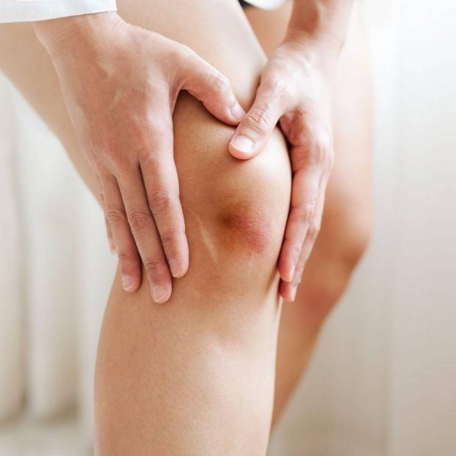 Hematix Gel 30g Desvanecedor De Moretones, Hematomas, Piel