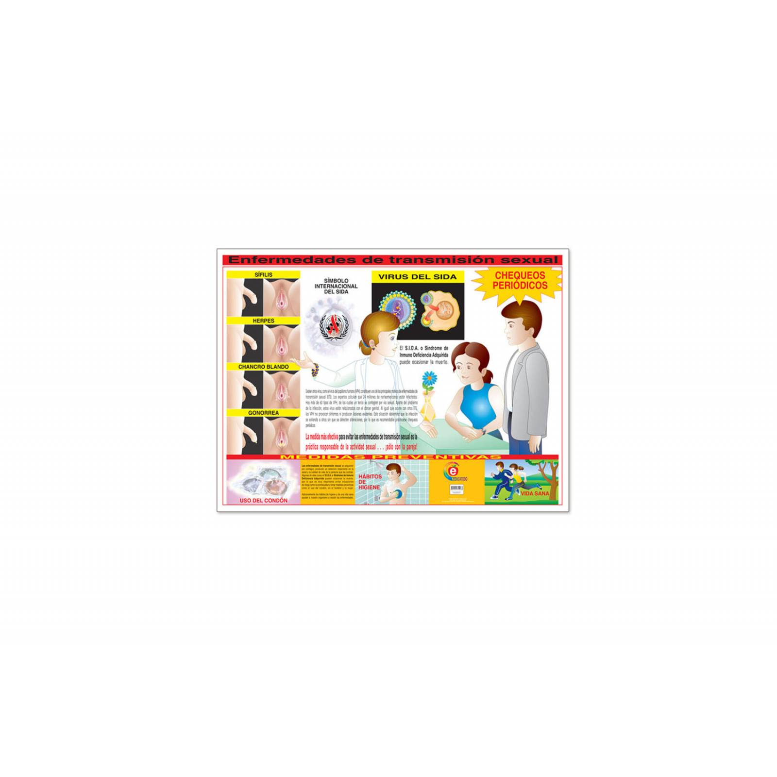 POSTER ENFERMEDADES DE TRANSMISION SEXUAL