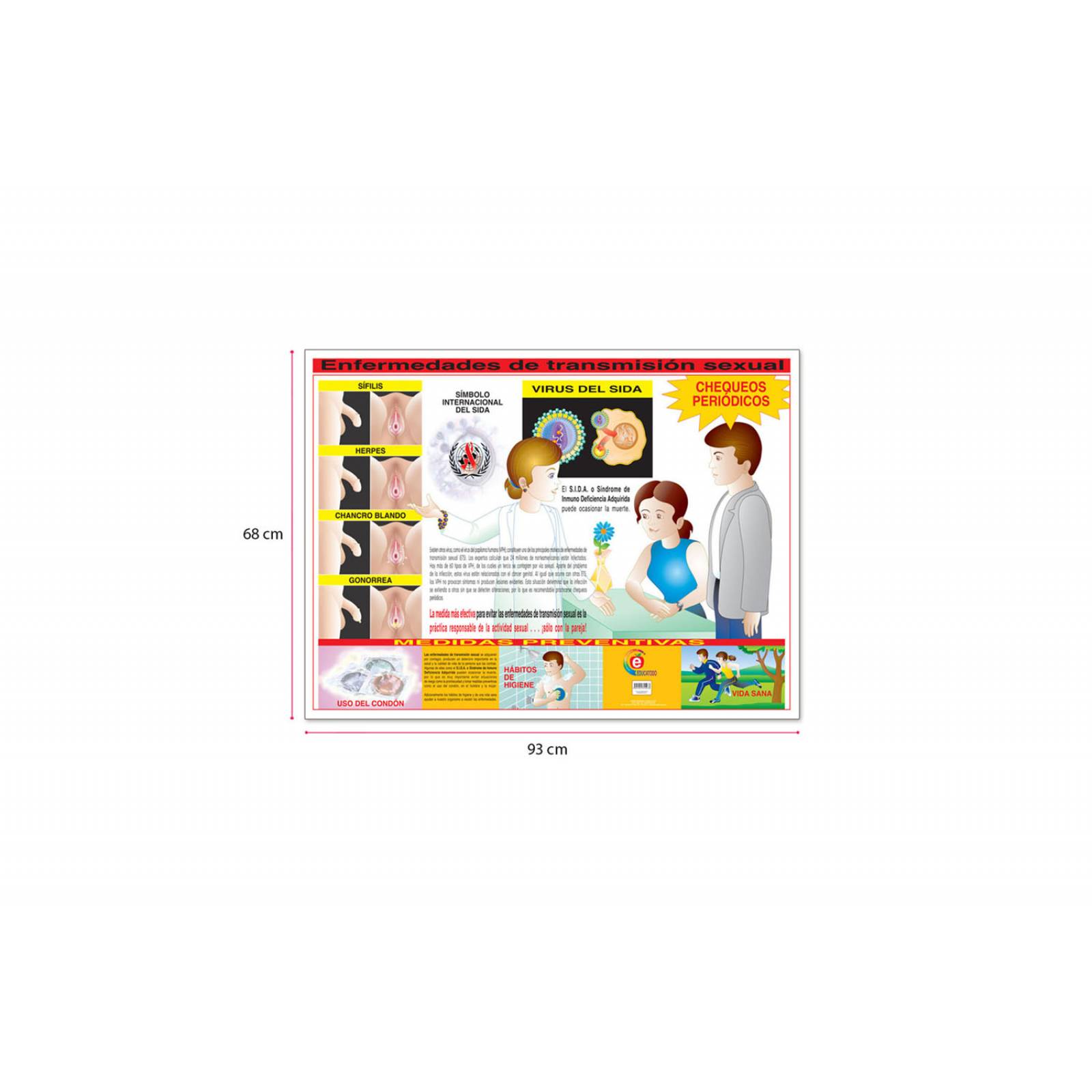 POSTER ENFERMEDADES DE TRANSMISION SEXUAL